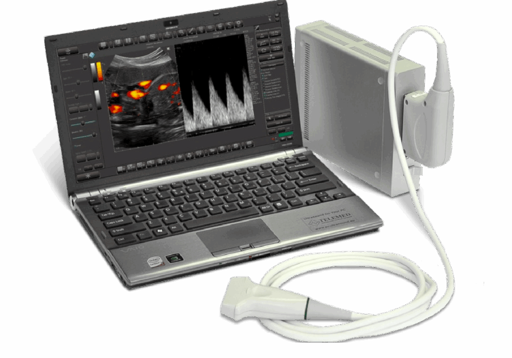 sonoview
